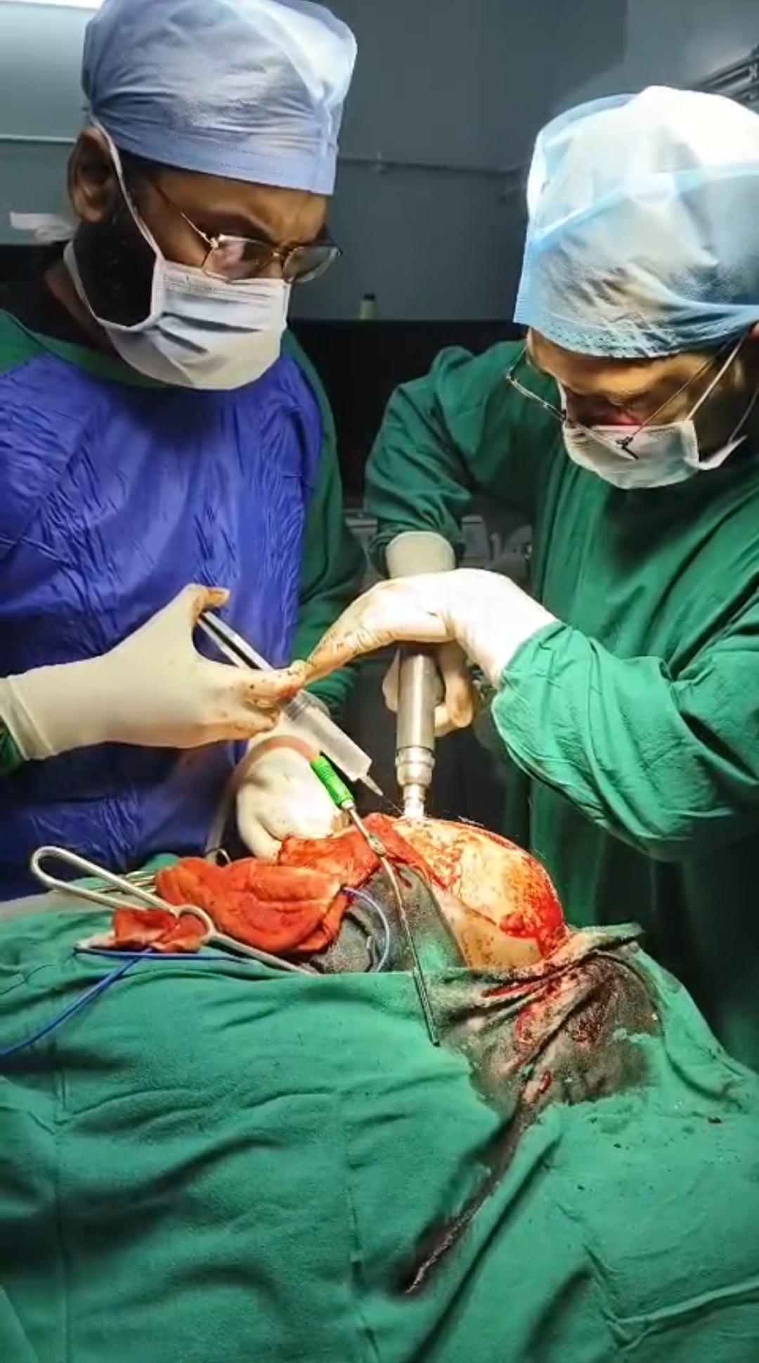 Neurosurgery